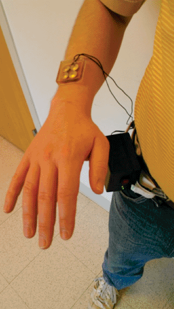 Image: The prototype low frequency ultrasound patch (Photo courtesy of Drexel University).